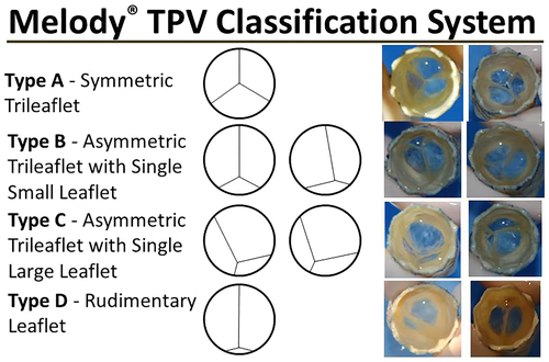 Melody TPV Classification System